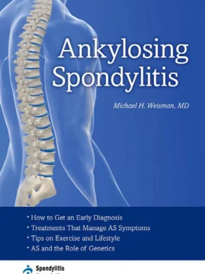 Ankylosing Spondylitis Michael H. Weisman
