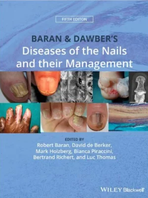 Baran Dawbers Diseases of the Nails and their Management Robert Baran David de Berker Mark Holzberg etc