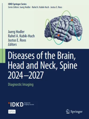 Diseases of the Brain Head and Neck etc